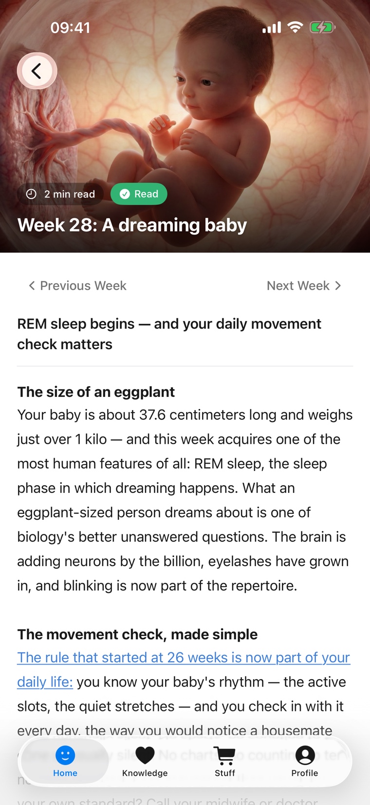 Novamilli weekly article